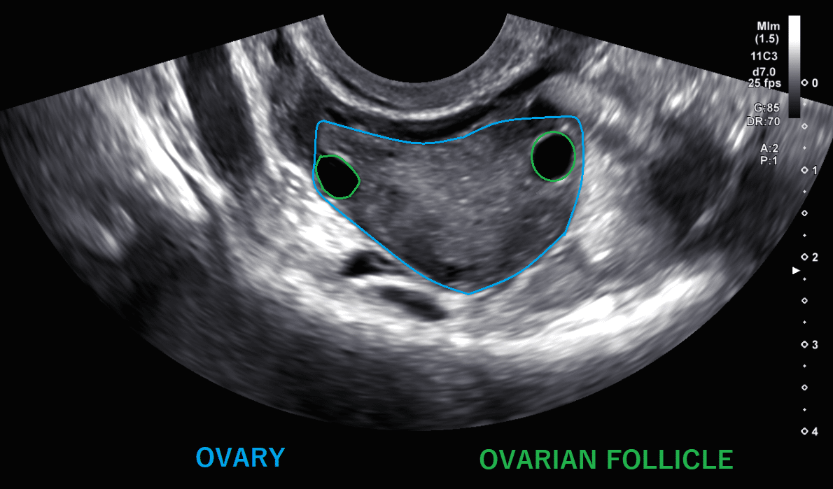 follicle